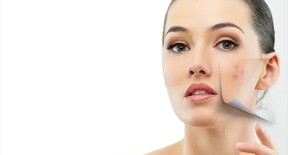 اختصاص الجلدية / إزالة الشعر بالليزر و العناية بالبشرة